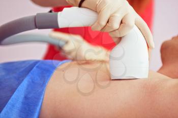 man receiving laser epilation at armpit on beauty center