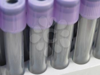 A row of laboratory test tubes with purple caps.