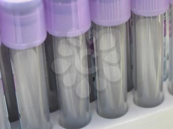 A row of laboratory test tubes with purple caps.