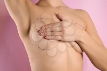 Young woman with marks on breast for cosmetic surgery operation against color background�