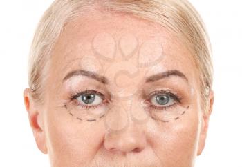 Mature woman with marks on her face against white background, closeup. Concept of plastic surgery�