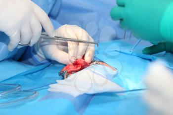 surgery on a lung of an infant