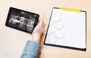 scientist analyzes X-ray picture of human jaws on screen on tablet pc