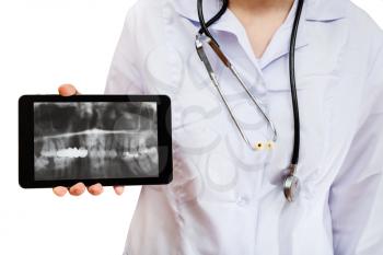 nurse holds tablet pc with dental X-ray picture of human jaws on screen isolated on white background