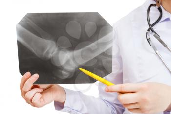 nurse shows X-ray picture with human knee joint isolated on white background