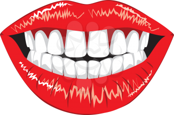 Red smiling female lips with white teeth on white background.