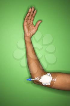 Royalty Free Photo of a Woman's Arm With a Bandage Gauze and IV