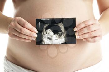 Royalty Free Photo of a Woman Holding an Ultrasound Scan