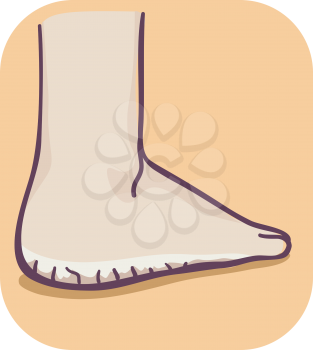 Illustration of a Dry and Thick Skin of the Feet