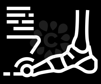 x-ray radiograph of foot gout diesase glyph icon vector. x-ray radiograph of foot gout diesase sign. isolated contour symbol black illustration