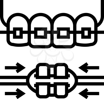 work process tooth braces line icon vector. work process tooth braces sign. isolated contour symbol black illustration