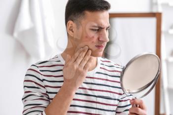Portrait of young man with acne problem looking in mirror at home�