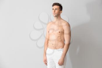 Young man with marks on his body against light background. Concept of plastic surgery�