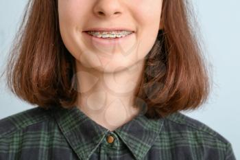 Teenage girl with dental braces on light background, closeup�