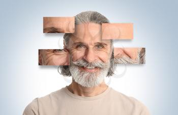 Portrait of mature man with skin problem on light background. Process of aging�