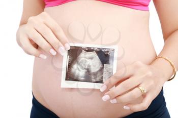 Pregnant woman's belly and ultrasound over white background. 
