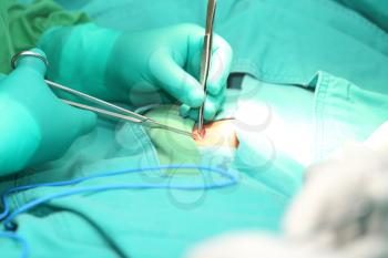 Surgeon hands suturing an hernia