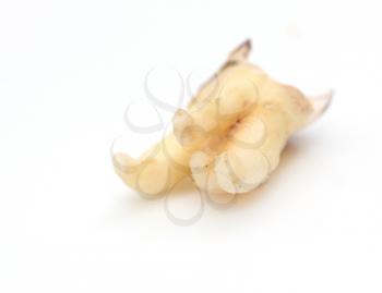 tooth decay on a white background