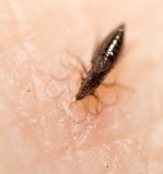 Flea on a human skin. Super macro