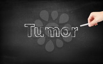 Tumor written on a blackboard