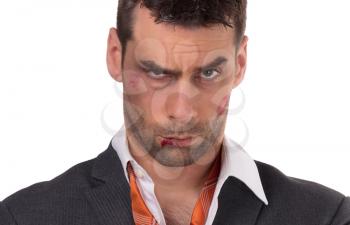 Close up of a businessman with bloody lip, beaten and bruised, isolated