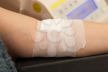 Blood donation process, woman with bandage on her arm