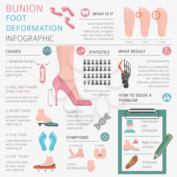 Foot deformation as medical desease infographic. Causes of bunion. Vector illustration