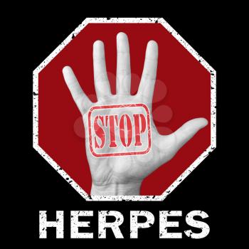 Stop herpes conceptual illustration. Open hand with the text stop herpes.