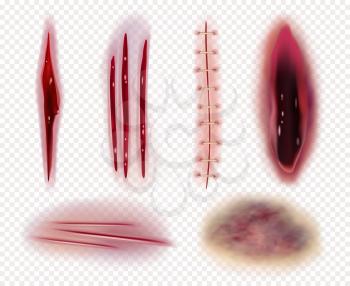 Realistic scars. Cuts wounds bruises bruises blood stitches vector templates collection. Illustration injury trauma, gross laceration coloring