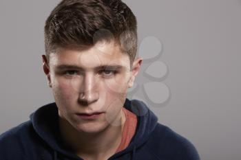 Teenage boy with serious expression, head and shoulders