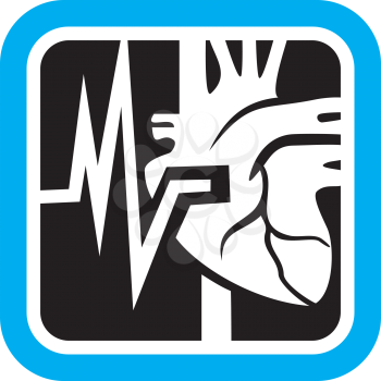 Royalty Free Clipart Image of a Cardiogram