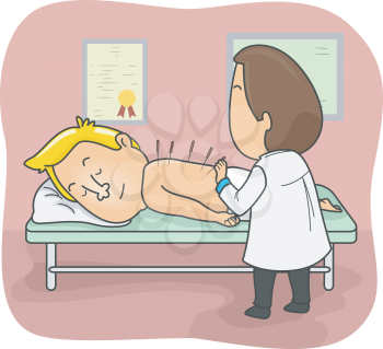 Illustration of an Acupuncture Sticking Acupuncture Needles on His Patient
