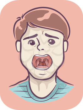 Illustration of a Teenage Boy with Open Mouth and Showing Sore Throat