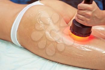 procedure for women hip against cellulite and fat