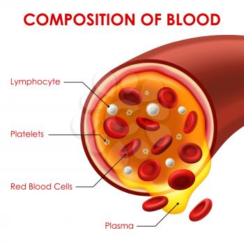 Composition of blood vector medicine scheme with vessel cross section, red blood cells, lymphocytes, platelets and plasma. Hematology medical aid, 3d bloodstream, human body anatomy of vascular system