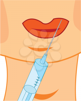 Vector illustration of the feminine lips and syringe for botox