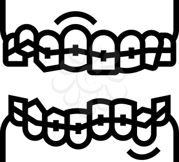 correction tooth braces line icon vector. correction tooth braces sign. isolated contour symbol black illustration