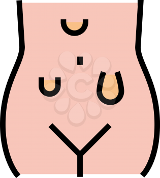 abdominal hernias disease color icon vector. abdominal hernias disease sign. isolated symbol illustration