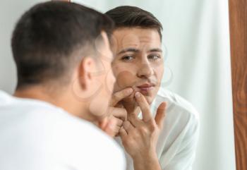 Portrait of young man with acne problem squishing pimples at home�