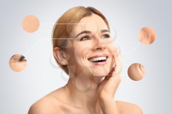 Portrait of beautiful woman with skin problem on light background. Process of aging�