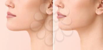 Young woman before and after plastic operation on color background, closeup�