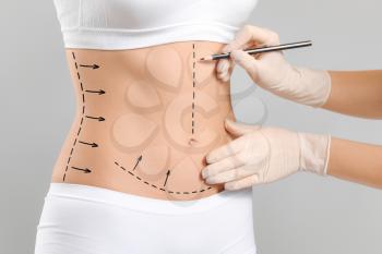 Plastic surgeon applying marks on woman's body against grey background�
