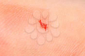 Royalty Free Photo of Blood on Skin