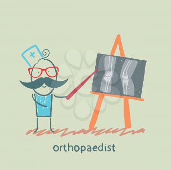 orthopaedist shows an X-ray