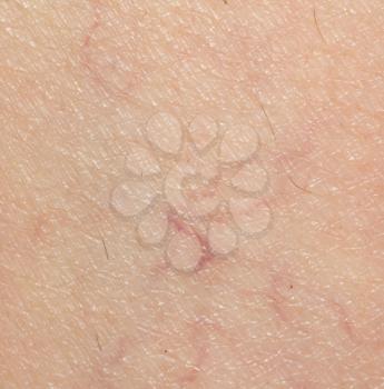 varicose veins on the skin. Macro