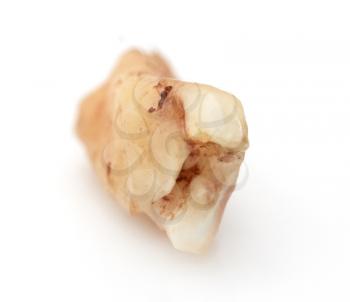 tooth decay on a white background. macro
