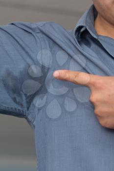 Man with hyperhidrosis sweating very badly under armpit in blue shirt