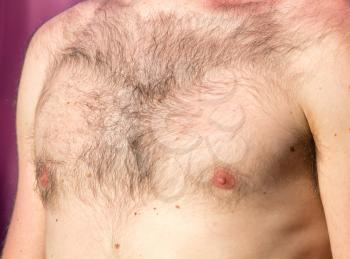 Hairy chest of a man in the open air .