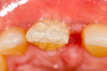 Teeth in a man's mouth as a background. macro