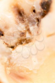 caries in the tooth. macro